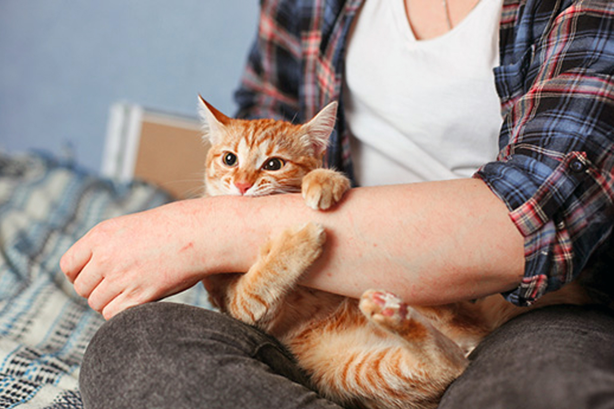 Even a minor cat scratch can cause Cat Scratch Disease. Know the symptoms.