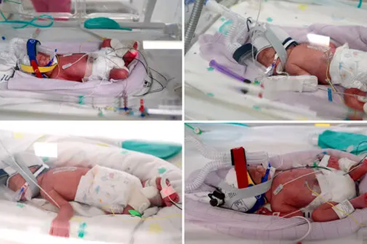 natural identical quadruplets one in 15 million