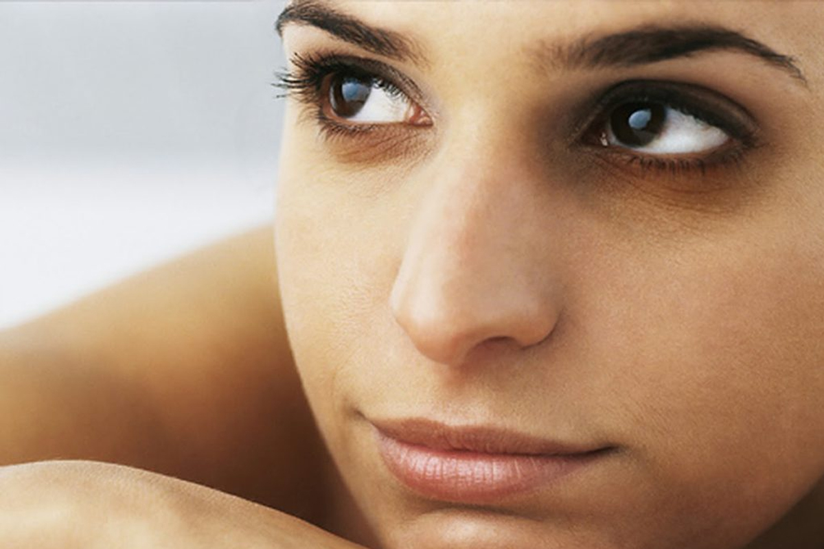 dark circles causes even after enough sleep