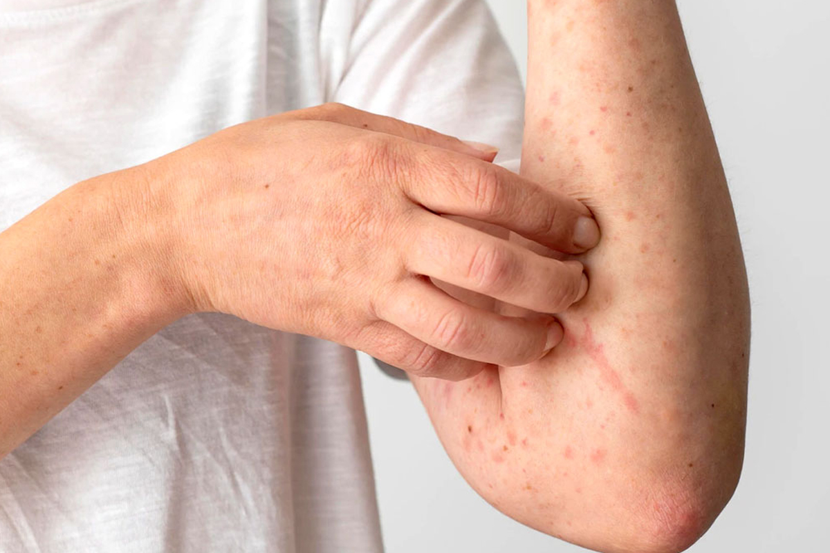 liver damage warning signs hands eyes