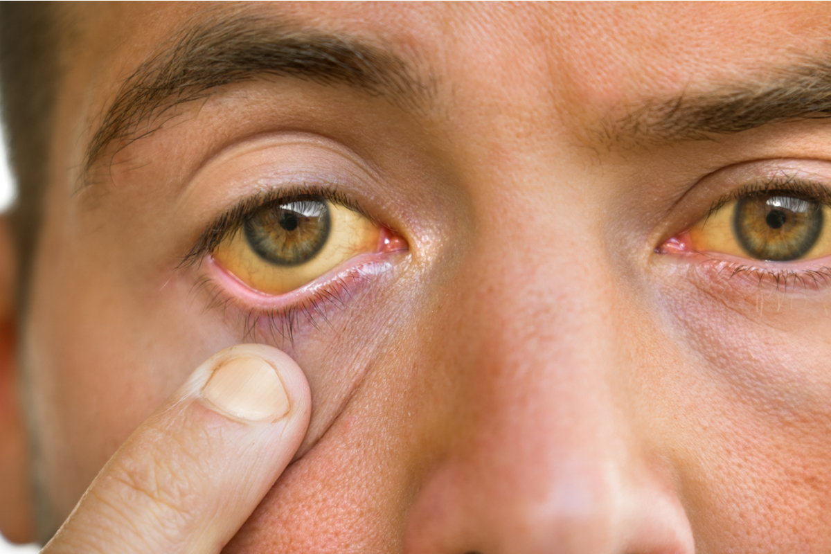 liver damage warning signs hands eyes