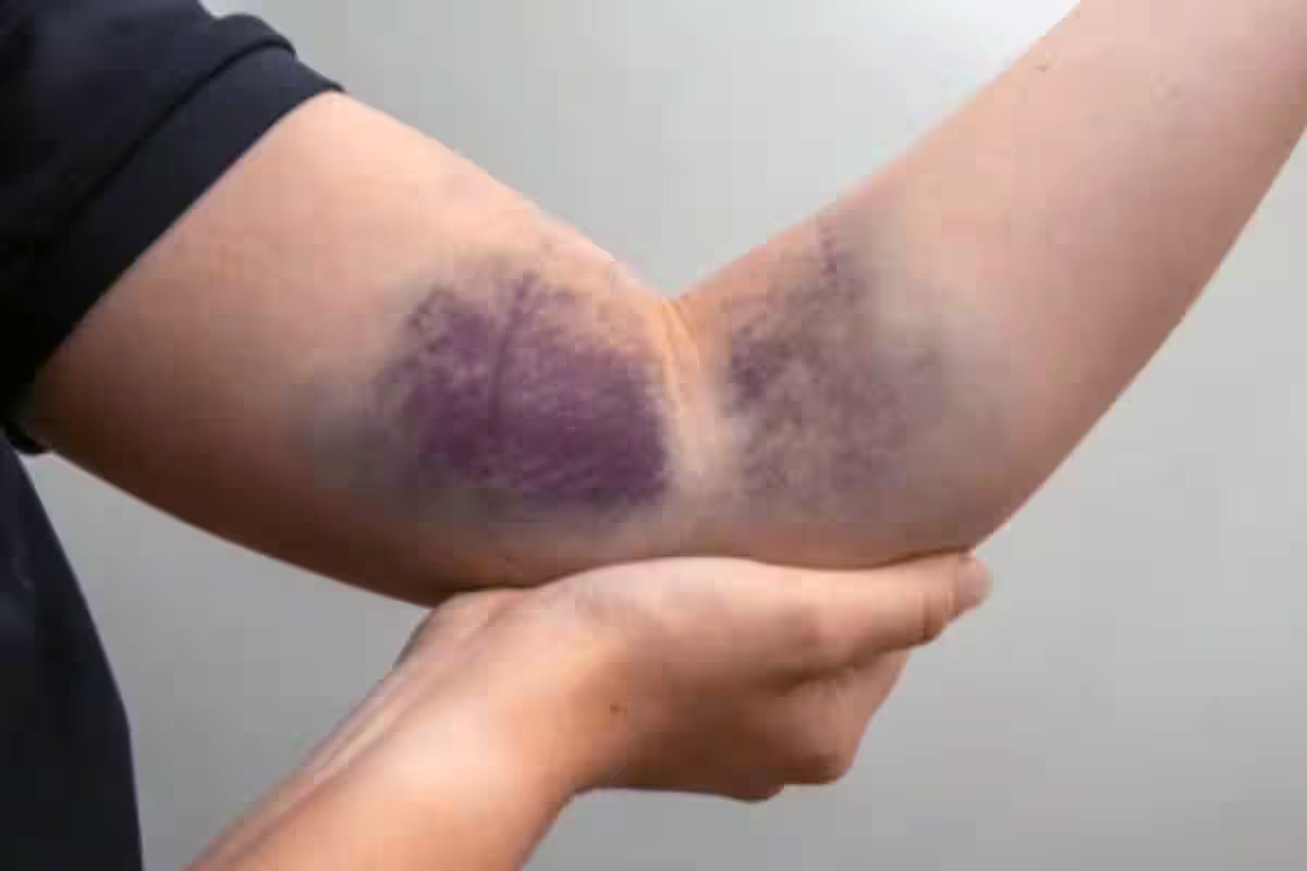 liver damage warning signs hands eyes