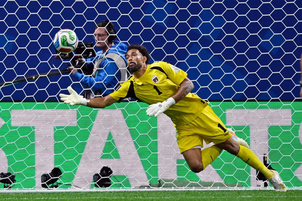 cape verde goalkeeper vozinha pterygium eye problem