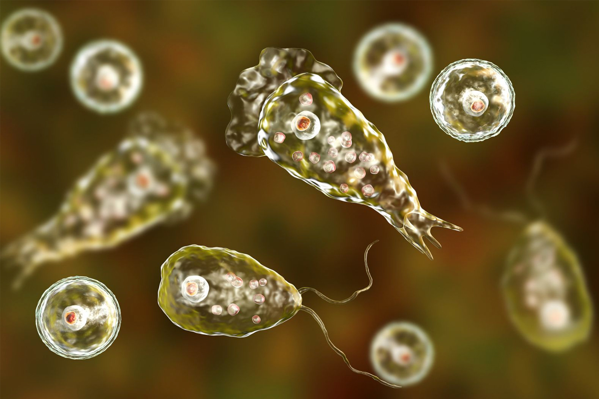 Brain-Eating Amoeba Infection