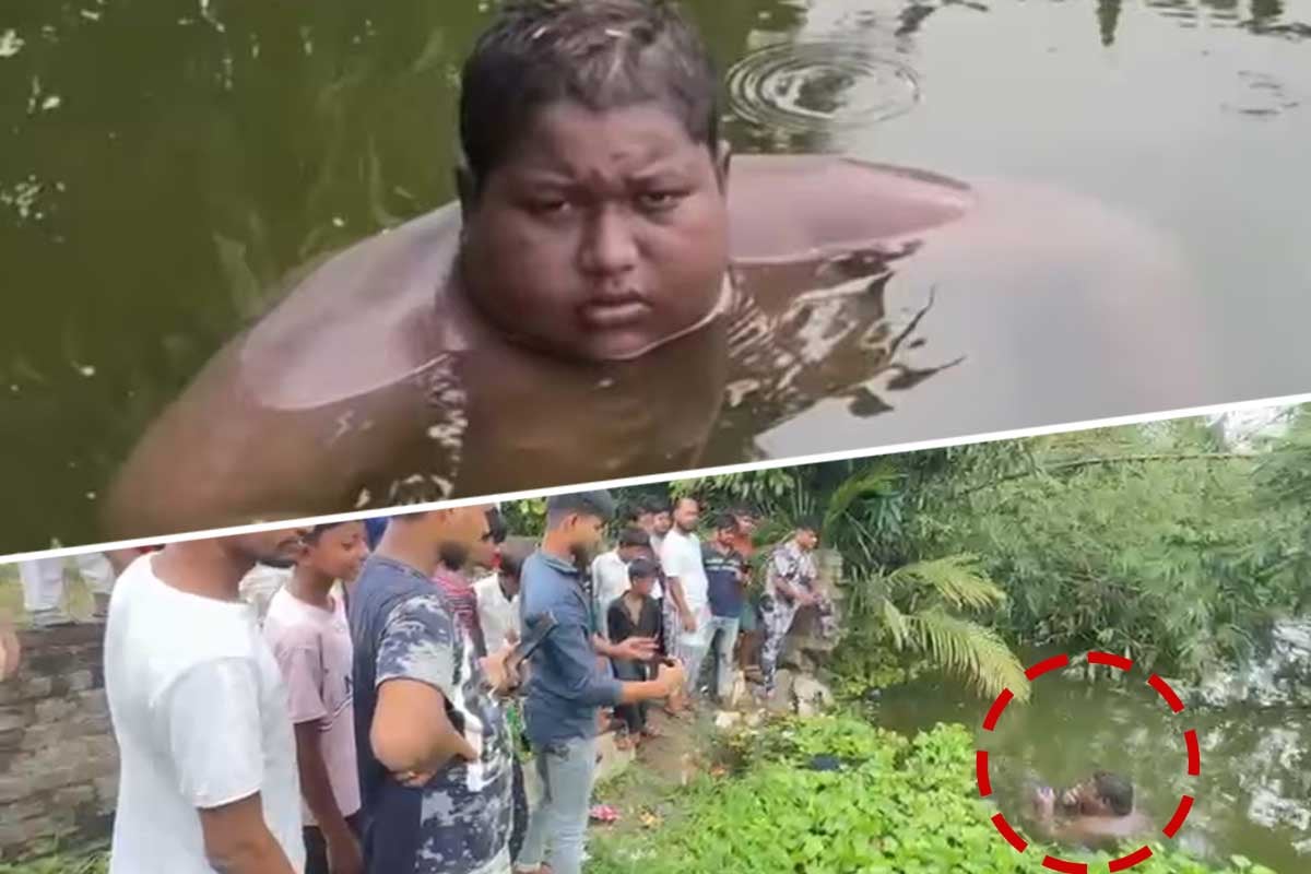 Teen Stays In Pond, Feels Burning Sensation Outside Wate