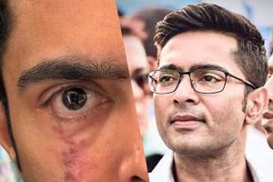 ‘আমি এখনও শেষ হয়ে যাইনি’, ইনস্টায় চোখের ছবি পোস্ট করে বিদেশ থেকে কাকে বার্তা অভিষেকের?