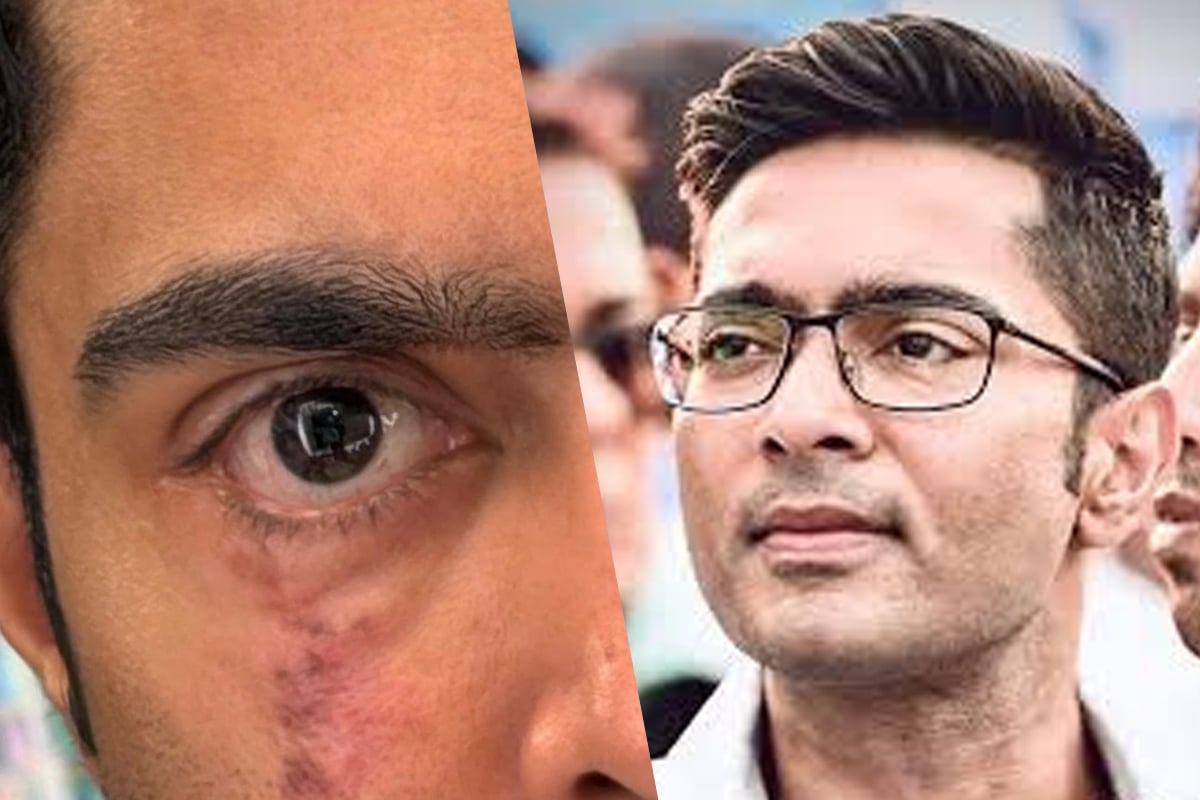 ‘আমি এখনও শেষ হয়ে যাইনি’, ইনস্টায় চোখের ছবি পোস্ট করে বিদেশ থেকে কাকে বার্তা অভিষেকের?