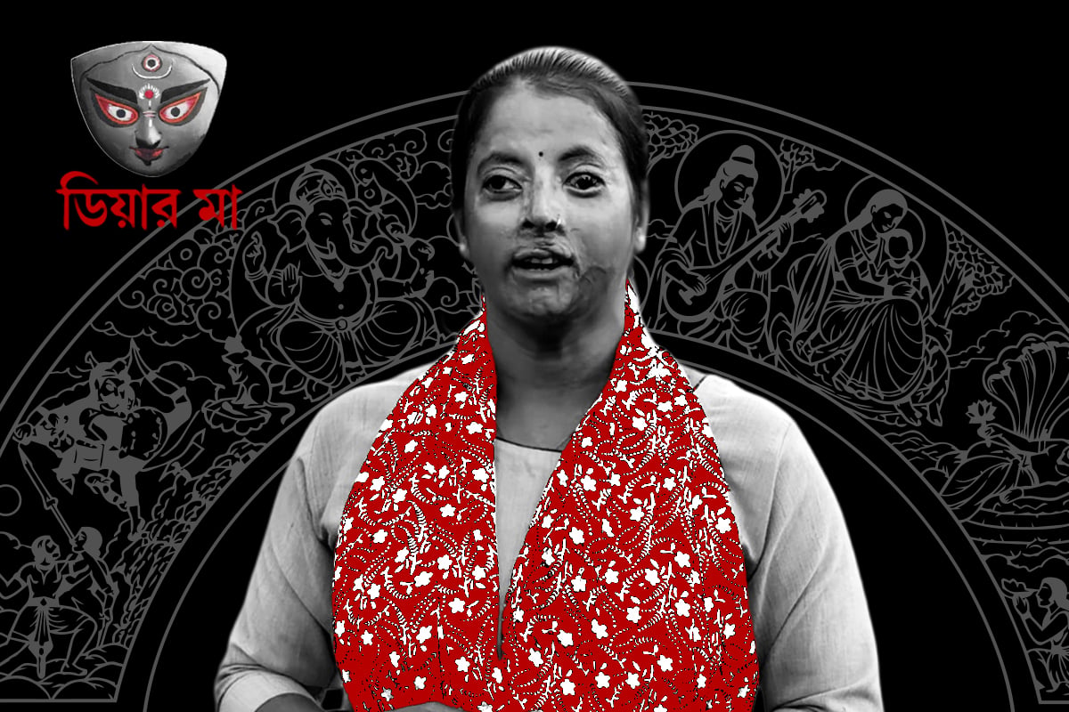 ১৪ বার অস্ত্রোপচার, দগ্ধ জীবনে শরৎ খুঁজে ফেরেন দেগঙ্গার কল্পনা