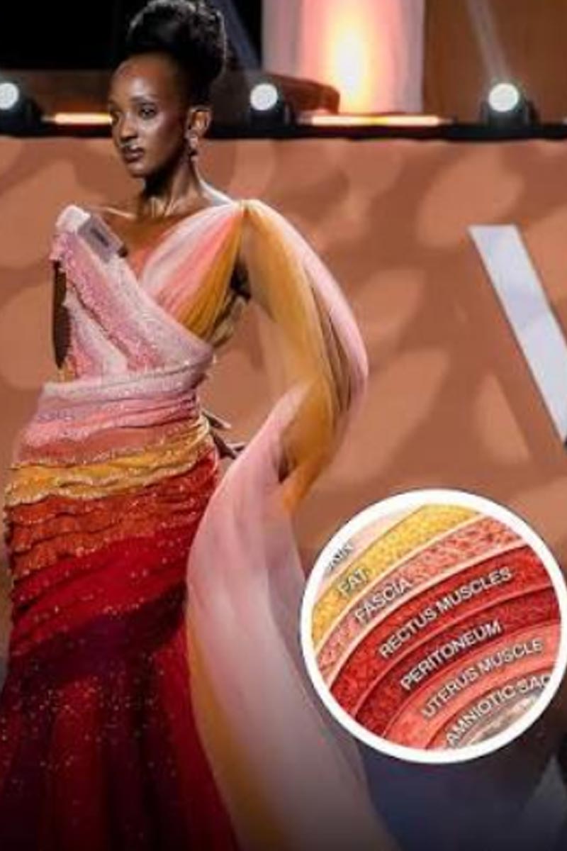 Miss Uganda’s ‘Layers of Life’ Gown Depicts 7 Layers of C-Section