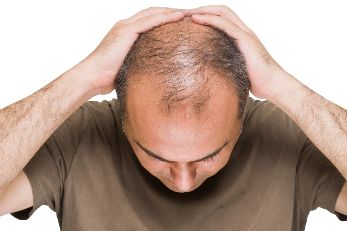 Laser cap for thinning hair treatment