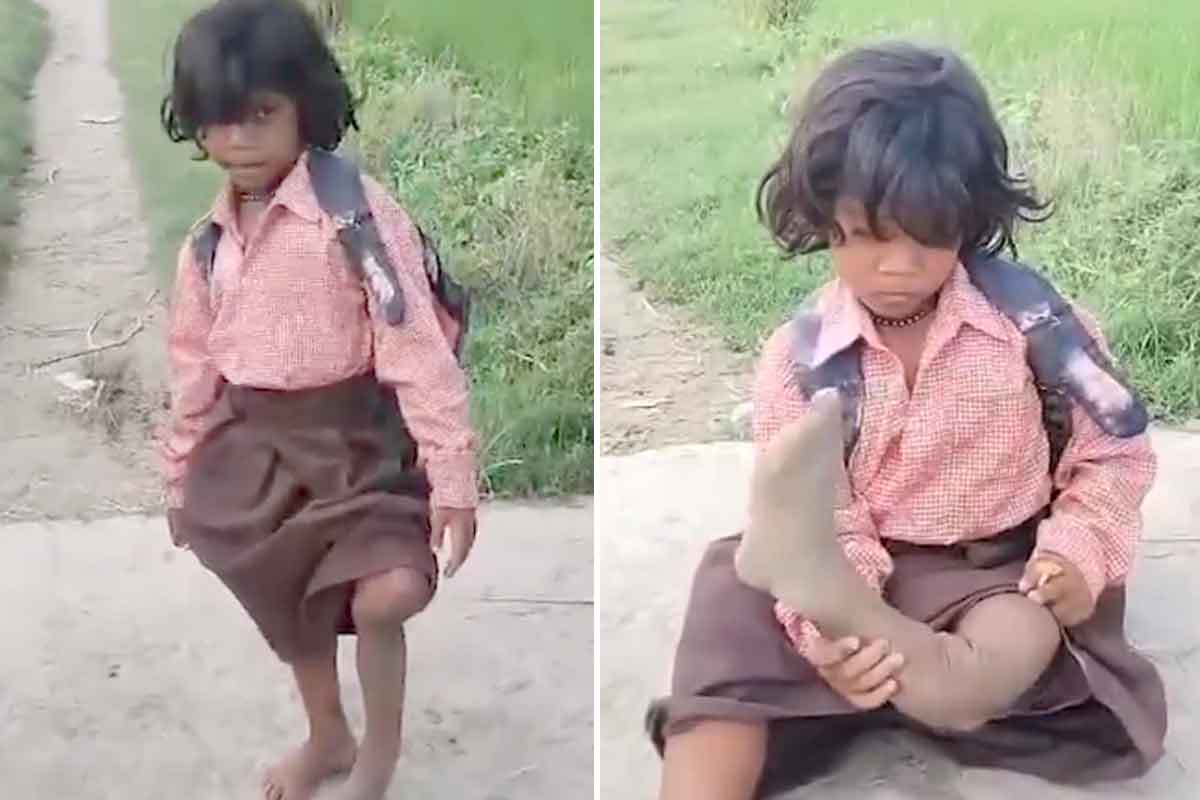 ৪০০ মিটার এক পায়ে লাফাতে লাফাতে স্কুলে, প্রশাসনের কাছে কী আর্জি ৭ বছরের খুদের? দেখুন ভিডিও