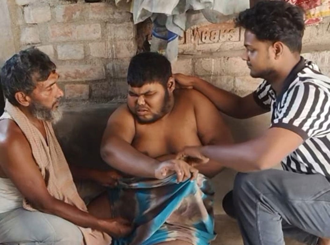 ১৫০ কেজির ছেলের রোজকার খোরাক দেড় কেজি চালের ভাত! আধার ঝামেলায় বন্ধ রেশন, দুশ্চিন্তায় বাবা