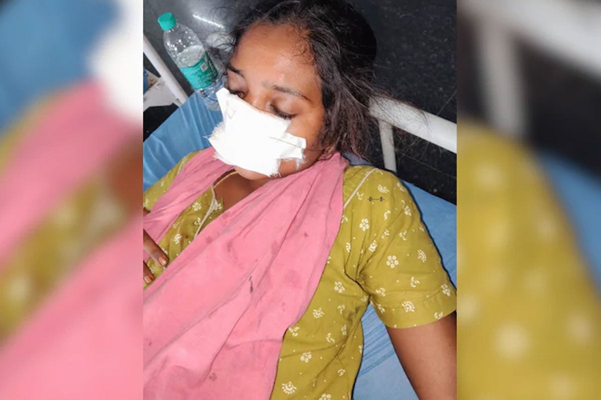 বাড়ি ফিরতে চাননি! স্ত্রীর নাক কামড়ে ছিড়ে নিল স্বামী