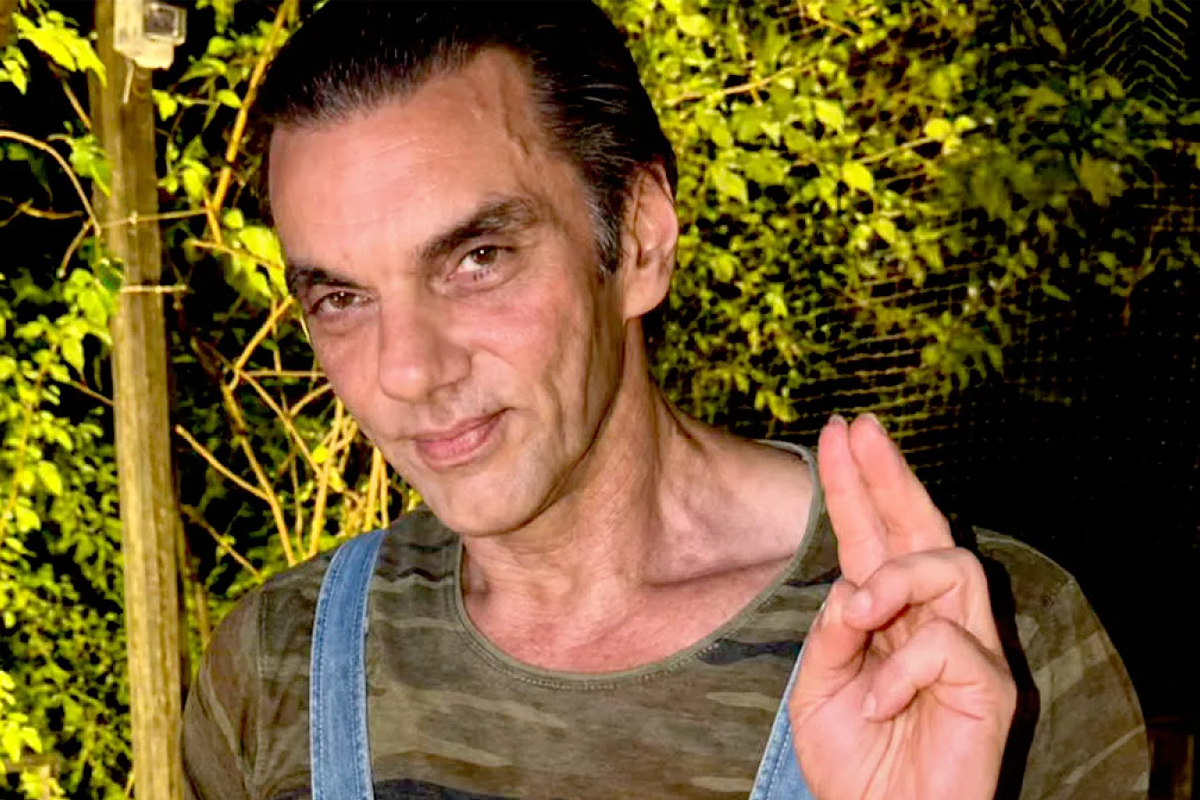 Rapid Weight Loss and Facial Volume Loss: Sohail Khan’s Transformation